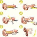 3rd Generation Male Penis Stretching Set